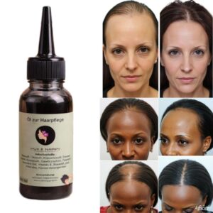 HUILE ANTI-CHUTE DE CHEVEUX ET ACTIVATEUR DE CROISSANCE RAPIDE