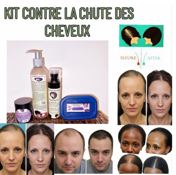 Kit Complet Anti-Chute – Force & Croissance Naturelle