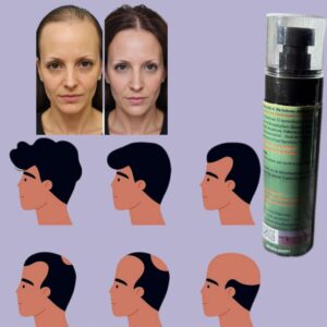 Spray Anti-Chute de Cheveux & Activateur de Croissance – Élixir Ayurvédique/Anti-Haarausfall & Wachstums-Aktivator Spray Ayurvedisches Revitalisierungs-Elixier